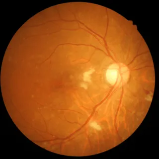Nahaufnahme Netzhaut Auge
